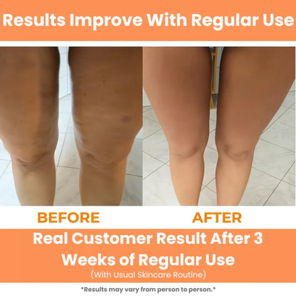 Round Ring Anti-Cellulite Deep